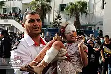 A man carrying a bloodied and bandaged child.