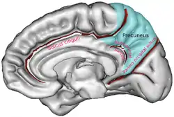 Boundaries of precuneus are defined by the three sulci. (shown in red) marginal branch of the cingulate sulcusparieto-occipital sulcussubparietal sulcus The area colored blue represents parietal lobe.