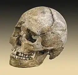 Image 4Skull of the Théviec burial. Female 25 to 35 years died a violent death with numerous skull fractures and bone lesions associated with the impacts of arrow.