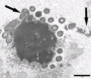 Electron micrograph of a virus factory in an amoeba co-infected with Mimivirus-dependent virus Zamilon (small particles) and Mont1. Arrows show abnormal Mont1 particles (scale bar: 0.1&nbsp;μm)